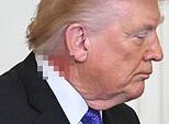 Trump desperta novos temores sobre a saúde à medida que os espectadores detectam um problema ‘desagradável’ em seu PESCOÇO