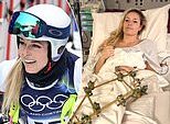 Lindsey Vonn compartilha uma declaração emocionada em meio a uma briga de aposentadoria nas redes sociais depois de quase perder a perna