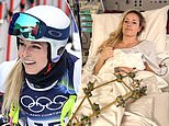 Lindsey Vonn compartilha uma declaração emocionada em meio a uma briga de aposentadoria nas redes sociais depois de quase perder a perna