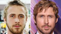 Ryan Gosling Bons genes ou bons médicos?!