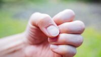 O que as mudanças nas unhas podem revelar sobre a sua saúde