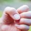 O que as mudanças nas unhas podem revelar sobre a sua saúde