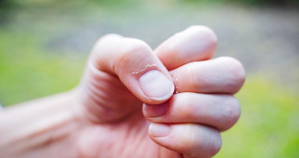 O que as mudanças nas unhas podem revelar sobre a sua saúde