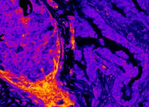 Metabolismo oculto encontrado operando dentro do núcleo da célula