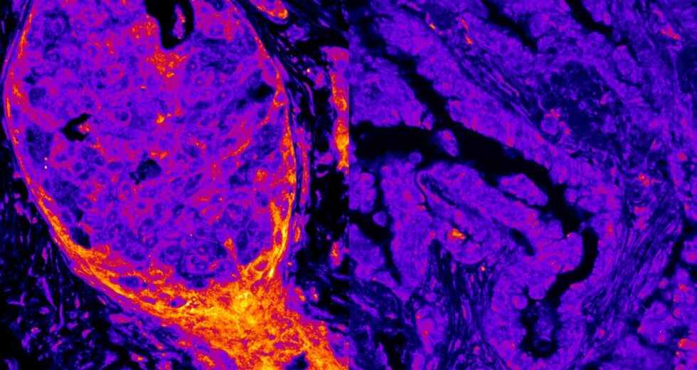 Metabolismo oculto encontrado operando dentro do núcleo da célula