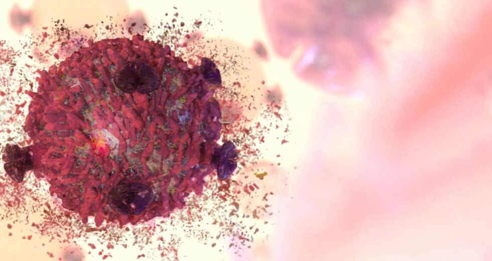 Novo nanomaterial de ferro elimina células cancerígenas sem danificar tecidos saudáveis