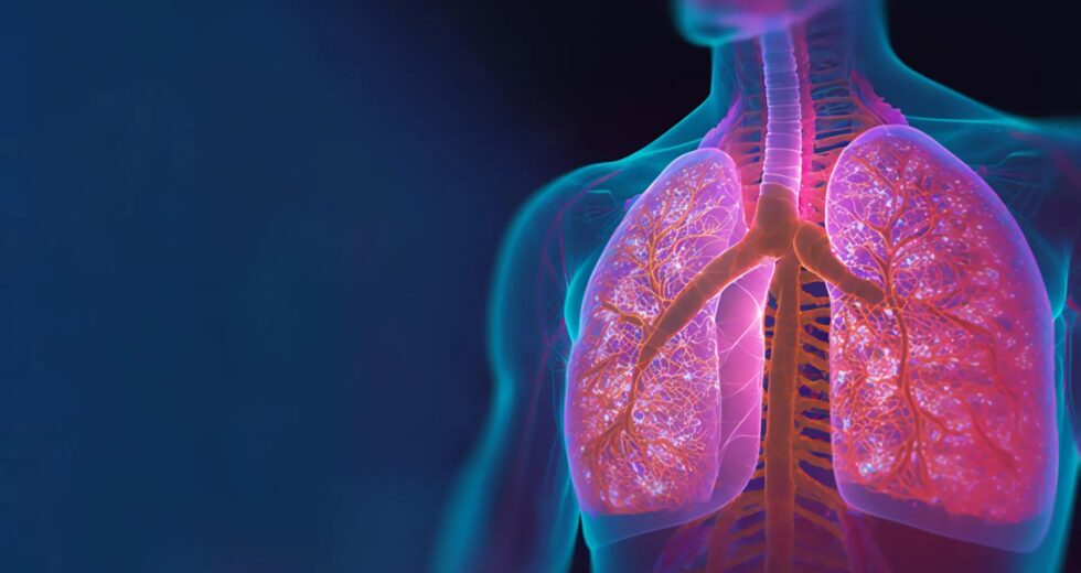 COVID grave ou gripe podem aumentar o risco de câncer de pulmão anos depois