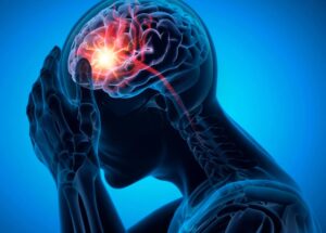 165.000 pacientes com demência revelam risco oculto de acidente vascular cerebral devido a medicamentos comuns