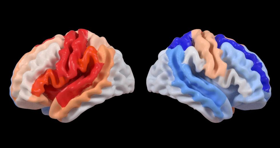 O AVC desencadeia uma mudança cerebral oculta que parece rejuvenescimento