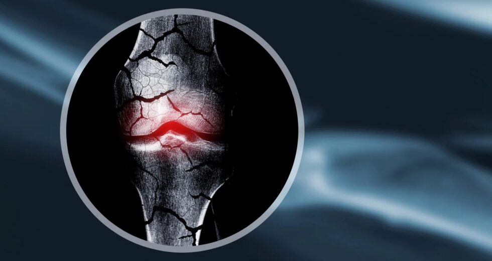 Cientistas criam estrutura de cartilagem que ajuda o corpo a regenerar ossos