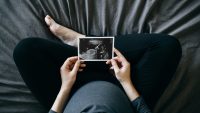 Early pregnancy care declines despite Trump’s pro-birth agenda