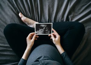 Early pregnancy care declines despite Trump’s pro-birth agenda