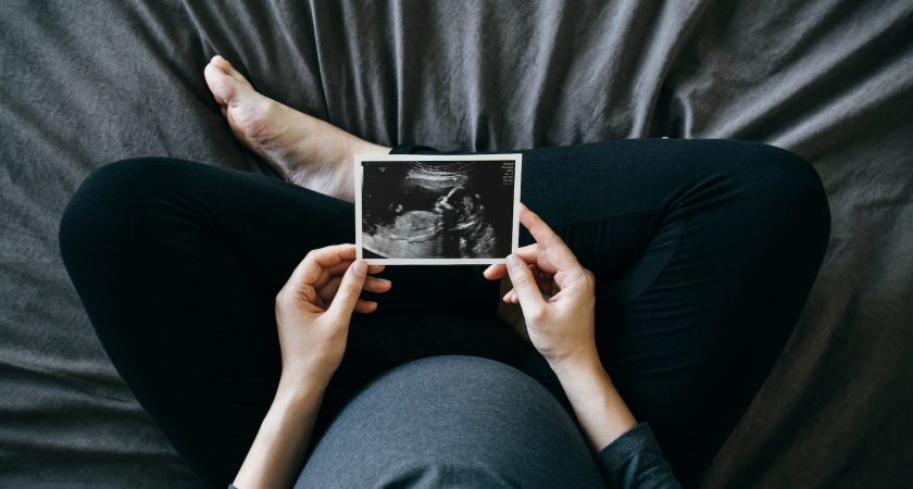 Ectopic pregnancy deaths have nearly doubled. It’s worse in states with abortion bans