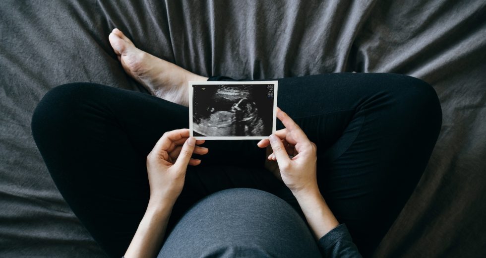 Early pregnancy care declines despite Trump’s pro-birth agenda